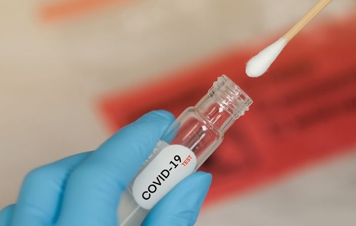 Над 1 400 са новите случаи на COVID-19 у нас